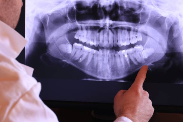 Best Emergency TMJ Treatment in Nampa, ID